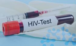 Türkiye'de bir ilk... İzmir'de ücretsiz  HIV testi merkezi açıldı!