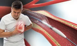 Uzmanlar uyardı: Stent korkusu hayatınıza mal olabilir!