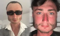 Yıllardır yaptığı spor yüzünden yüzü kare oldu