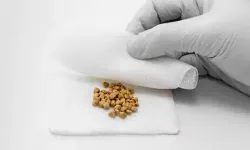 Belirtiler mide ağrısıyla karıştırılıyor: Safra taşlarına dikkat!