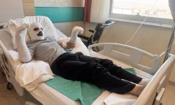 Çay demlerken dehşeti yaşadı: Vücudunun yüzde 26'sı yandı!