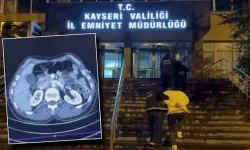 Midesinden uyuşturucu çıkan 3 İranlı gözaltında