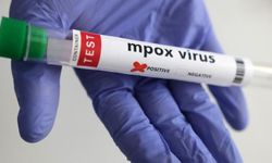 Maymun çiçeği virüsünün yeni bir türü tespit edildi