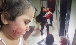 Küçük çocuk yaralandı... Çiğli’de köpek saldırısı!