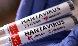 İsrail'de bir kişide hantavirüs tespit edildi!