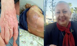 Huzurevindeki ölümde tartışmalı karar... 6 taksitli 21 bin lira ceza!