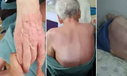 Huzurevindeki ölümde 6 taksitli cezanın gerekçesi: Önlem almamışlar!
