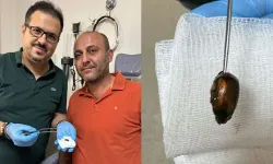 Ağrı ve işitme kaybıyla hastaneye gitti... Kulağından çıkan şok etti!
