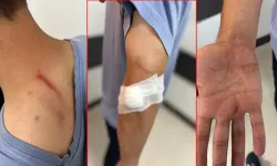 İlaç raporu tartışmasında tıbbi sekreteri darbetti!