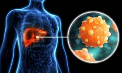 300 milyondan fazla kişi enfekte: Viral hepatitlere dikkat