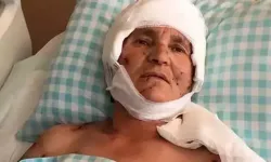 Köpek saldırısında yaralanan kadına 637 bin lira tazminat!