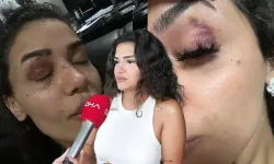 Uzaklaştırma kararına rağmen evinin önünde darp edildi!