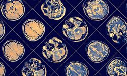 Alzheimer tanısında kan testi dönemi!