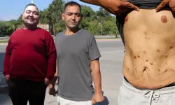 Tüp mide ameliyatı sonrası hayatı karardı!