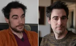 Fransız oyuncu Arnaud Denis ötanaziyle yaşamına son verdi