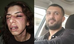 Eşinin şiddet uyguladığı Seda Nur: Ölmek istemiyorum