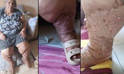Çaresiz evladın yardım çığlığı: Annem gözümüzün önünde tükeniyor!