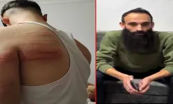2 çırağını dövdüğü iddia edilen berber gözaltına alındı