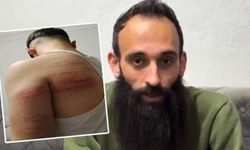 2 çırağını demir sopayla dövdü: Berber şiddeti