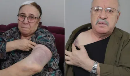 Komşu vahşeti: Yaşlı çifti sopa kırılana kadar darbettiler!