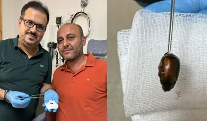 Ağrı ve işitme kaybıyla hastaneye gitti... Kulağından çıkan şok etti!