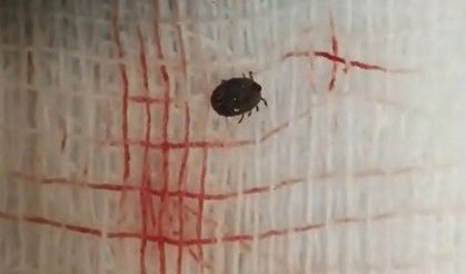 Kene bir can daha aldı: Yaşlı adamın acı sonu!