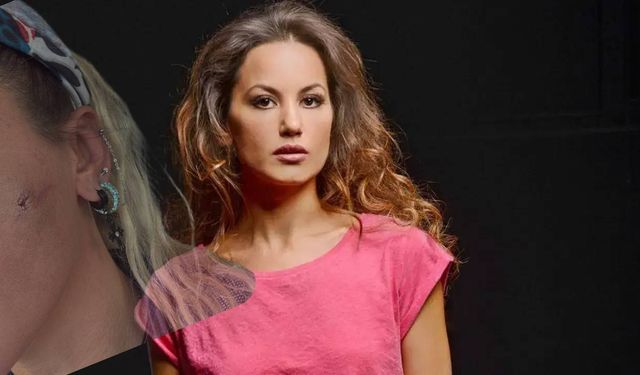 Sanatçı Yıldız Asyalı eşinden şiddet gördüğünü açıkladı