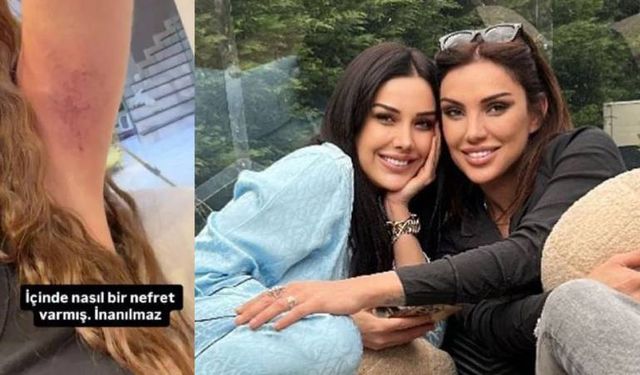 Sıla Doğu, Dilan Polat'ı dövdü!