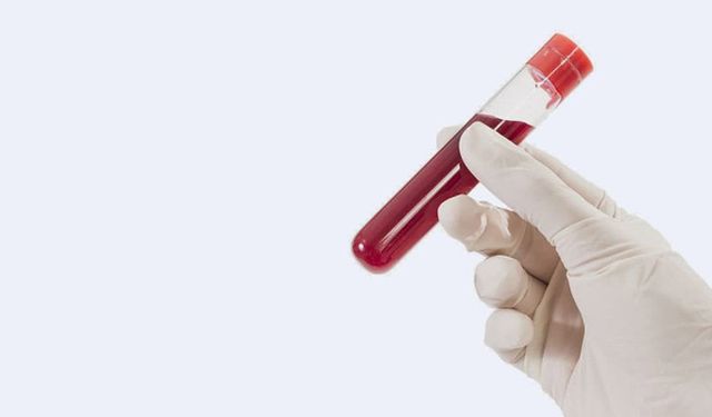 Tahliller için çarpıcı iddia: Başkasının kanıyla ‘temiz’ raporu!