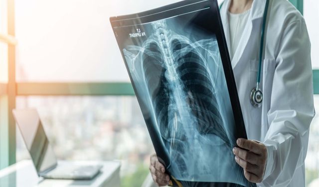 Uzmanından solunum yolu enfeksiyonları uyarısı: Hijyen şart!