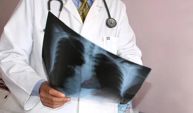 Soğuk havalarda zatürreye dikkat: Erken müdahale önemli