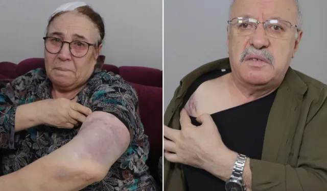 Komşu vahşeti: Yaşlı çifti sopa kırılana kadar darbettiler!