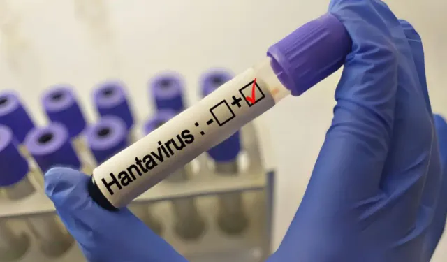 Grip ile karıştırılıyor: Uzmanlardan 'hantavirüs' açıklaması