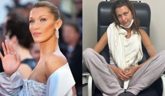 Bella Hadid paylaşımıyla hayranlarını endişelendirdi: Tedaviler işe yaramıyor!