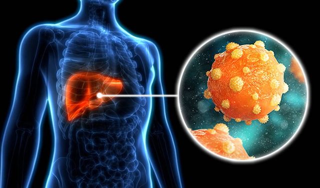 300 milyondan fazla kişi enfekte: Viral hepatitlere dikkat