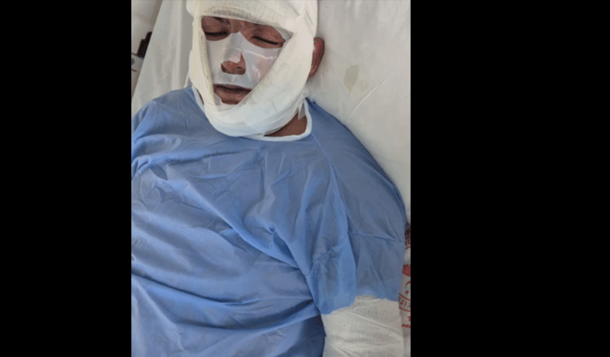 Gençleri yakan hata: Çakmağı çaktı, araç alev aldı!