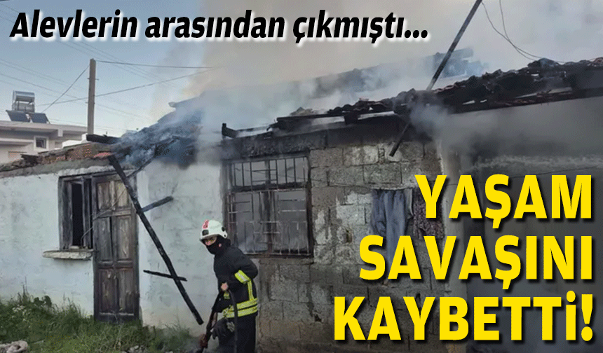 Alevlerin arasından çıkmıştı... Hayata tutanamadı!