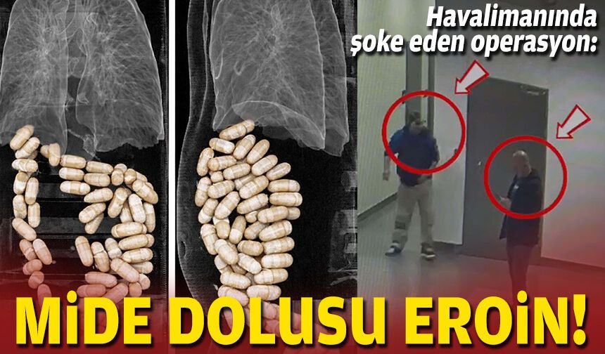 Havalimanında şoke eden operasyon: Mide dolusu eroin!