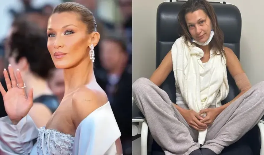 Bella Hadid paylaşımıyla hayranlarını endişelendirdi: Tedaviler işe yaramıyor!