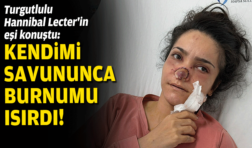 Turgutlulu Hannibal Lecter'in eşi konuştu:  Kendimi savununca burnumu ısırdı!