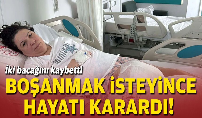 Boşanmak isteyince hayatı karardı: İki bacağını kaybetti