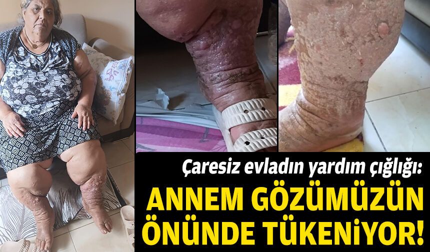 Çaresiz evladın yardım çığlığı: Annem gözümüzün önünde tükeniyor!