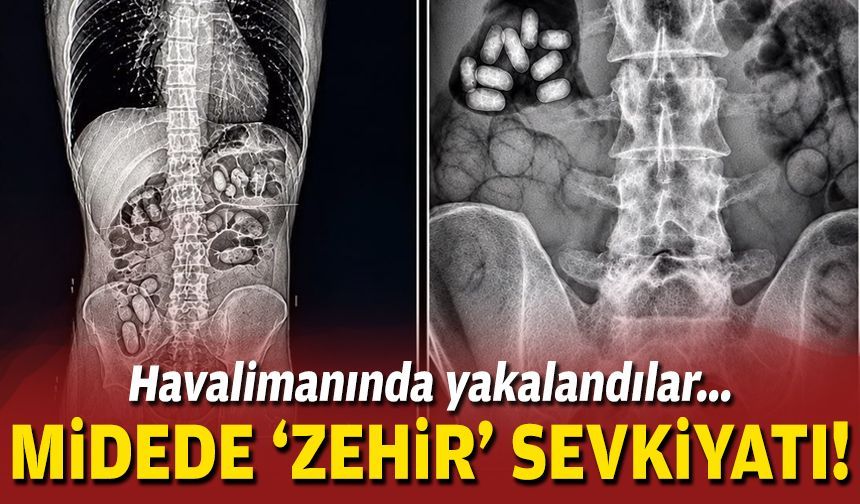 Havalimanında 'zehir' operasyonu: Midesinden uyuşturucu çıktı!